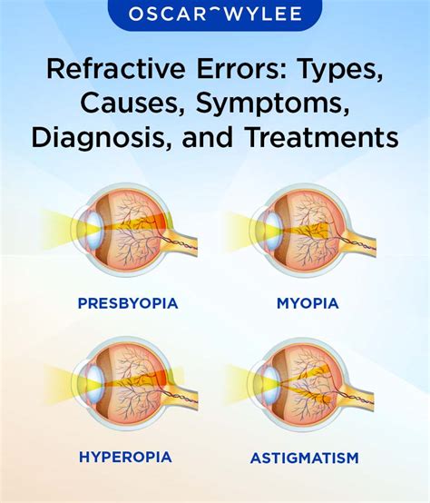 refractometer percent error|ophthalmic refractive errors.